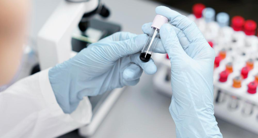 ВИЧ на Кубани: 1564 новых случая за 10 месяцев, но основной удар — по людям 40+