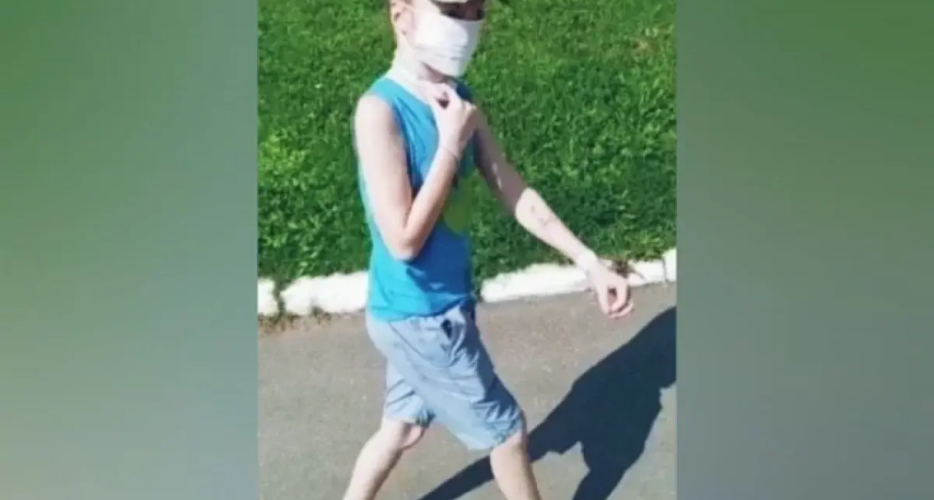 10-летнему Вале, которому хаски разорвали лицо, частично восстановили губу в первой операции 2026 года