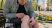 В Краснодарском крае с начала года клещи укусили почти 600 человек