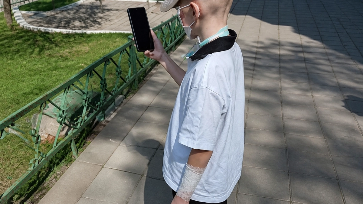 Пострадавшему от нападения хаски мальчику из Сочи провели операцию на губах
